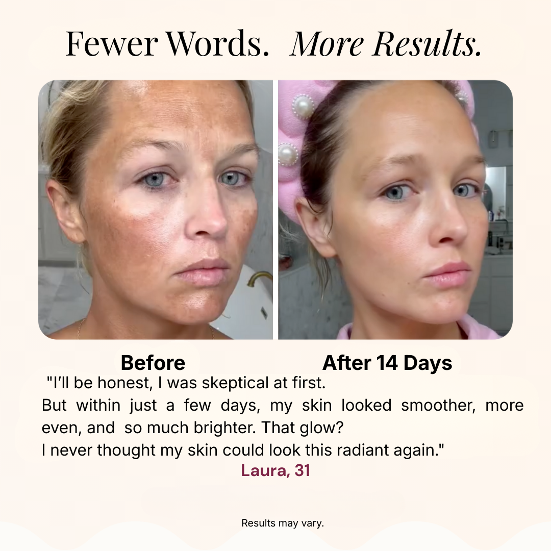 Shine Bright – Dark Spot Corrector Pads